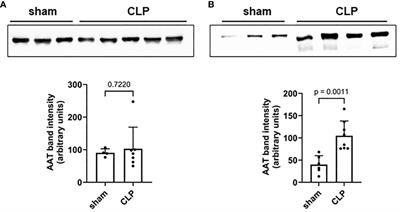 Alpha1-antitrypsin improves survival in murine abdominal sepsis model by decreasing inflammation and sequestration of free heme